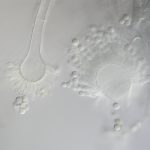 Aspergillus Flavus Spores, Conidiophore