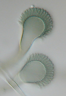 Aspergillus fumigatus