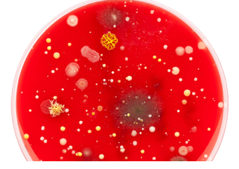 Bacteria on blood agar plate
