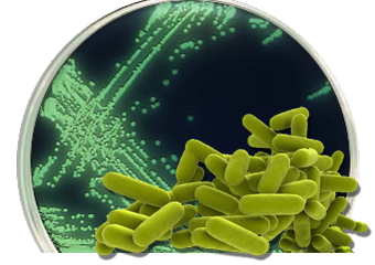 legionella