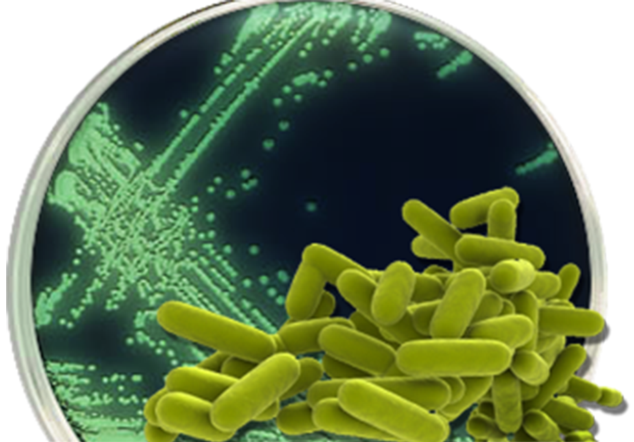 Legionella pneumophila qPCR [LQPCR]