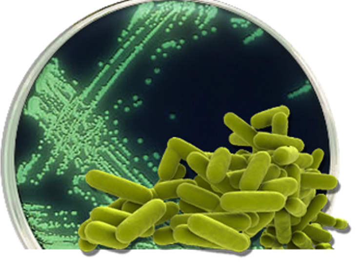 Legionella pneumophila qPCR [LQPCR]