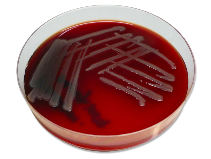 Pseudomonas aeruginosa culture [PSEUDO]